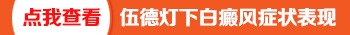 寶寶身上長白斑是不是白癜風怎么判斷