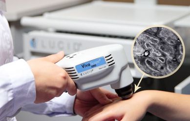 皮膚三維ct檢查白癜風有沒有單子