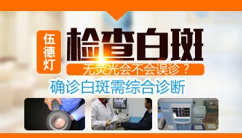 皮膚鏡跟伍德燈檢查白斑有什么差別