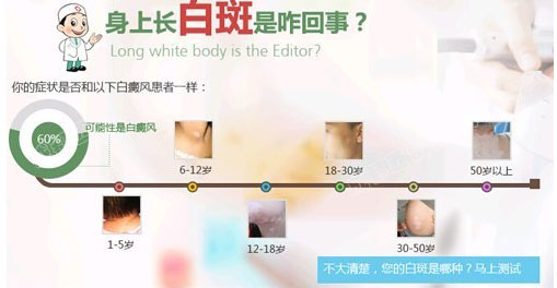 1白斑.jpg