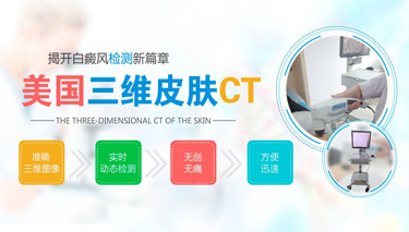 背部白癜風的癥狀有哪些特點，癥狀表現是什么