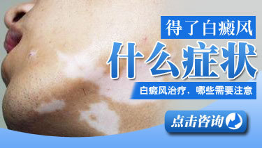 白癜風(fēng)的癥狀