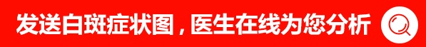 白癜風白斑在皮膚上一般有什么明顯感受
