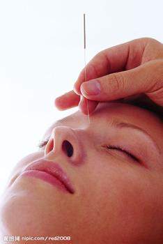 針灸治療白癜風(fēng)效果怎么樣