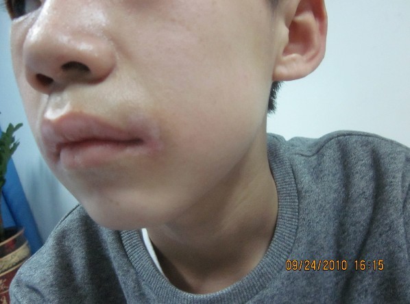 平山中醫治療白癜風的好醫院