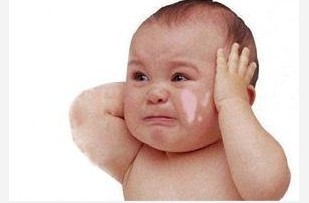 小兒面部長(zhǎng)白癜風(fēng)該用什么方法治療?