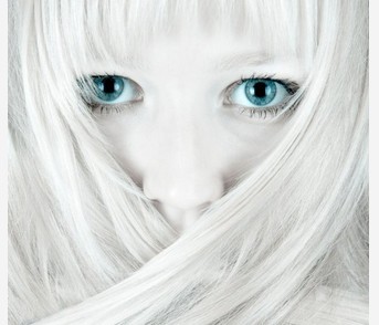 因為白癜風而使得頭發變白能治好嗎?