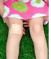 肢端型白癜風是不是可以治好?