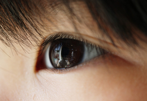 眉毛有白癜風可以治療好嗎