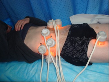 白癜風手術需要多少錢