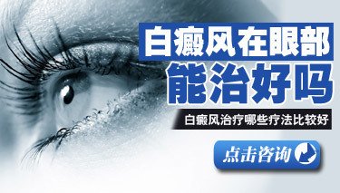 白癜風的治療周期一般有多長