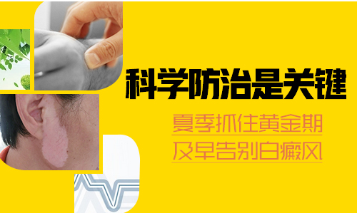 治療白癜風有什么好方法