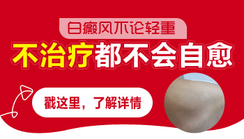 白癜風(fēng)