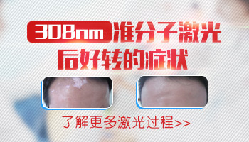 照完308白斑發紅