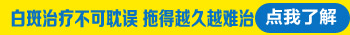 治療早期白癜風抹地奈德乳膏可以嗎