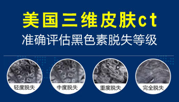 植皮治療白癜風一平方厘米大概多少錢