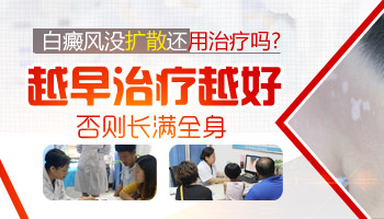 白癜風在治療期間會不會擴散