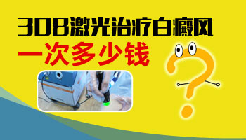 308激光照一次白癜風大概花多少錢