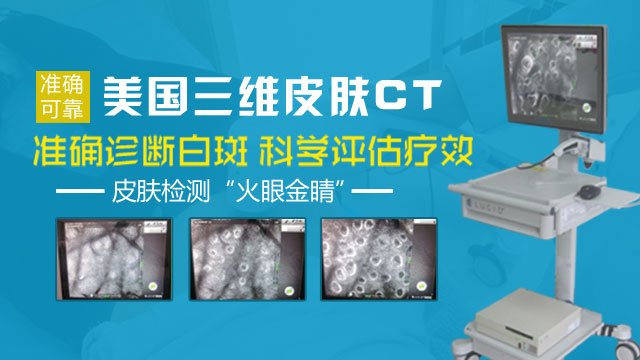 白癜風(fēng)照ct可以吃東西嗎