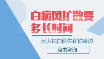 白癜風擴散要多長時間