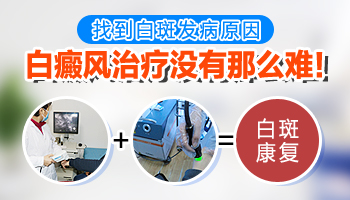 白斑做什么檢查能查病因