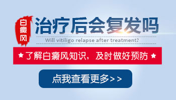 <strong>激光治療白癜風以后白斑消失還會不會復發</strong>