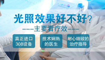 單一使用308照白癜風效果太慢了怎么辦