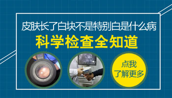 臉上兩塊不明顯白斑參加高考體檢受影響嗎