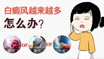 腿部白癜風越來越多怎么治療好