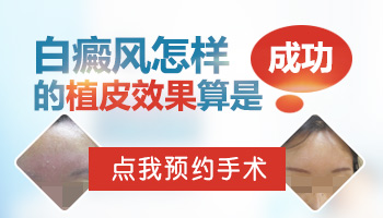 手關(guān)節(jié)白癜風(fēng)做移植手術(shù)成功幾率高嗎