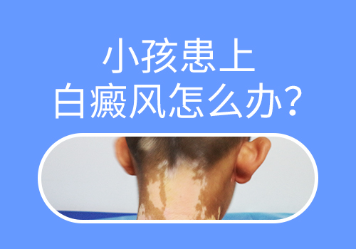 脖子有發展期白癜風照308激光好不好,一次多少錢