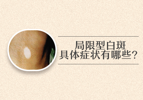 1歲孩子頭部發現白斑用311紫外線好還會308激光好