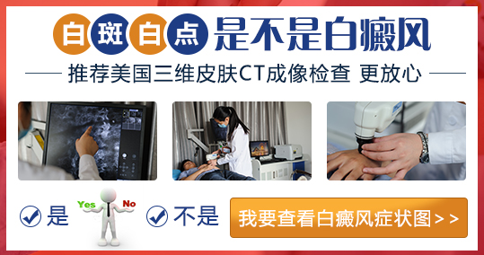 脖子有白癜風照進口308激光一次多少錢