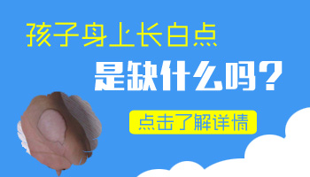 7個月孩子腰部有一小塊白斑照伍德燈是淡白色是白癜風嗎