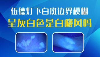 7個月孩子耳朵黃豆大白斑抹他克莫司能治好嗎