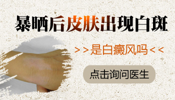 胸部白癜風(fēng)有拳頭大照308激光好不好，一次多少錢