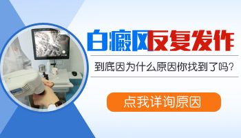 身上有發(fā)展期白癜風(fēng)照308激光要多少錢