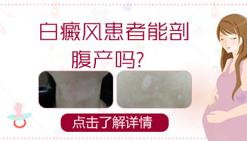 7個月孩子脖子有塊白斑能用黑色素移植手術治療嗎