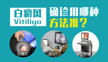 肚子長有一片白斑照308激光一周幾次 一次多少錢