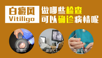 7個(gè)月孩子脖子硬幣大白斑伍德燈檢查為陽(yáng)性是白癜風(fēng)嗎
