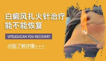 胳膊白斑有雞蛋大照308激光要多少錢