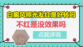 兒童額頭巴掌大白斑照完308紅多久是正常的