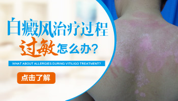 頭部長有一片白斑照308多少錢,長期照射好嗎