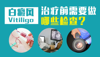 7個(gè)月孩子脖子有塊白斑照308nm激光多久能好轉(zhuǎn)