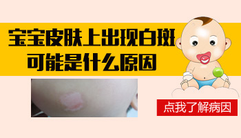 7個月孩子脖子黃豆大白斑哪種偏方效果好