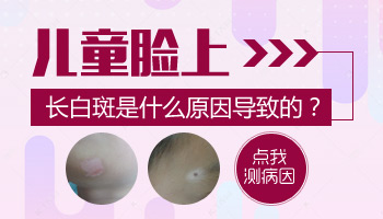 8個月孩子腳上硬幣大白斑照UVB能治得好嗎