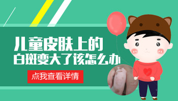 嘴角有發展期白癜風用308nm準分子激光照多少錢