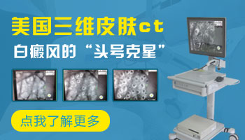 肚子白斑有雞蛋大照美國308nm激光多少錢