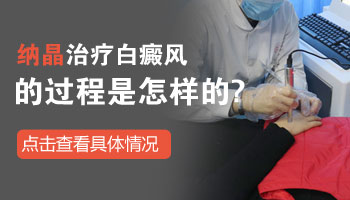 7個月孩子脖子發(fā)現(xiàn)白斑照美國308激光效果好不好