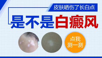 逐漸變大的白癜風該怎么用藥恢復的快